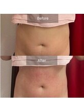 エモーション(E Motion)/before→after☆