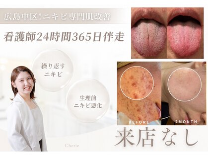 シェリー(Cherie)の写真