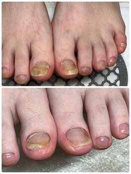 ブルーネイル(Blue Nail)の写真/お爪のコンプレックス・お悩みご相談下さい♪長くネイルを楽しんでほしい自爪想いの施術が人気の秘密☆