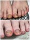 ブルーネイル(Blue Nail)の写真/お爪のコンプレックス・お悩みご相談下さい♪長くネイルを楽しんでほしい自爪想いの施術が人気の秘密☆