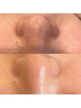 ベリーベリー 九条店(VERY-VERY)/