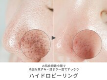 クリード(CLEAD)