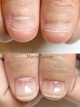 マリーロール 梅田店(Marie Laure)/自爪育成/深爪矯正/ネイルケア
