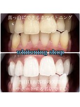 ホワイトニングショップ 柏店/美白ホワイトニング