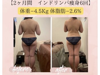 オキシー グレイス 小倉店(OXY Grace)/20代お客様ビフォーアフター