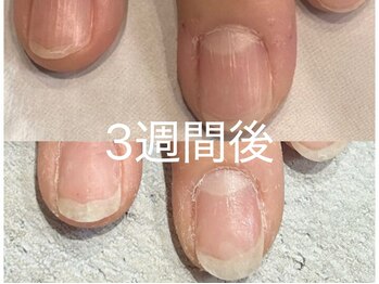 グレースレディ/癖もいつのまにか…