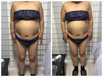 グランドール(Grandeur)/痩身