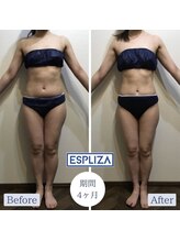 エスプライザ 鹿児島天文館店(ESPLIZA)/