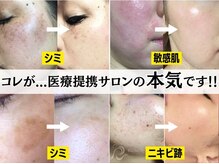 パルファンカルム 駅西本町店/驚きの肌変化にリピーター続出！