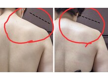 ラグーン(Lagoon)/WINBACK×筋膜リリース