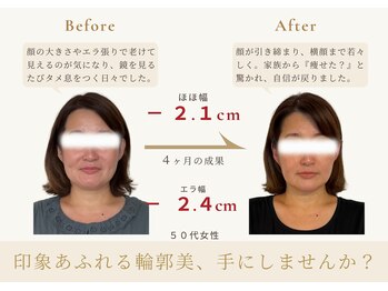 アロハ(ALOHA.)/印象を変える輪郭、手にしない?