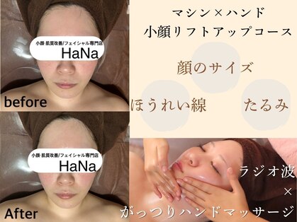 ハナ(HaNa)の写真