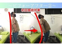 ケアるら整骨院 富里院/ビフォーアフター