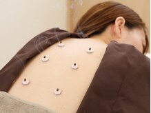 リターズ鍼灸治療所 天王寺院の雰囲気（お灸/あたため/冷え改善/自律神経症状/季節の変わり目に効果的◎）