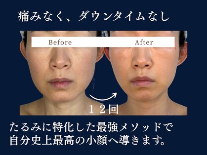 ジュジュ(juju)の写真
