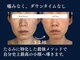 ジュジュ(juju)の写真