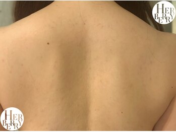 ハーバリー ハーブピーリング 栄(HERBERRYハーブピーリング)/ハーブピーリング専門店HERBERRY