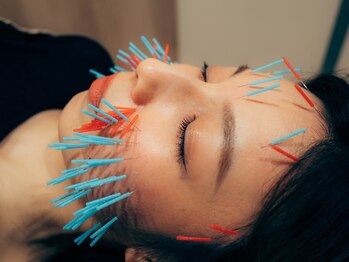 くすの樹接骨院 整体院 町田院/[美容鍼/鍼灸]リフトアップ/小顔