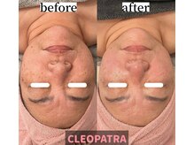 クレオパトラ(CLEOPATRA)の雰囲気（一度の施術で変わるのは当たり前。継続でお肌の細胞から変える！）