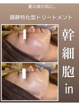 ヨロ(YOLO)/リアボーテ鎮静トリートメント