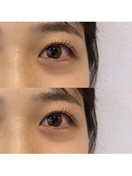 フィービー(pheebe)/カールデザイン