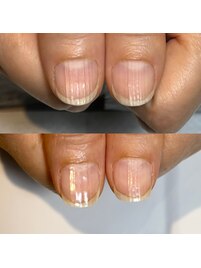 ジェルなし地爪育成ケア