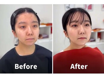 ルミエルスタイル 上野御徒町店(LUMIEL STYLE)/イエベ秋のお客様 BEFORE→AFTER