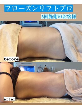 カーム(CALM.)/お腹スッキリ