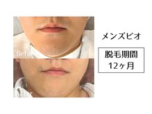 メンズビオ 神戸三宮店/