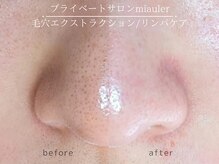 ミオレ(miauler)