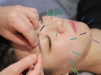 エンビューティー(EN beauty)の写真/肌の老化ほうれい線、たるみが気になる方歓迎！大人の為の美容鍼なら当店へ！八王子駅徒歩5分