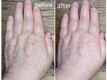 エクラ(eclat)/☆美容液ミスト☆