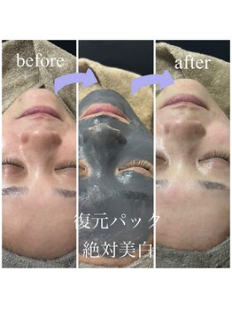 ルチル(Rutile)/復元パック