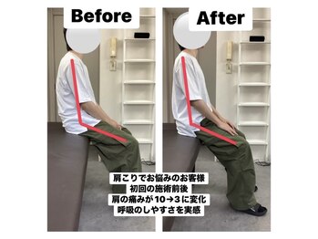 アンティオール 中目黒店/慢性的な肩こり改善整体