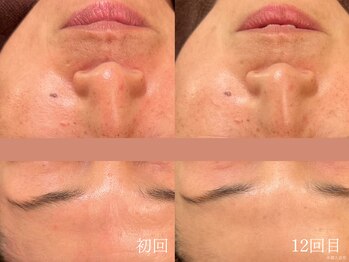 ウォーム(warm)/マッサージ/エステ/フェイシャル