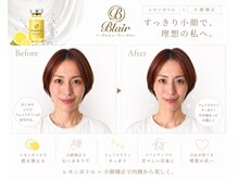 ブレア(Blair)