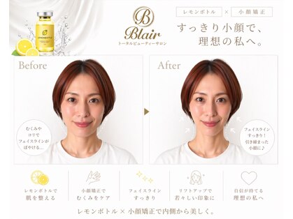 ブレア(Blair)の写真