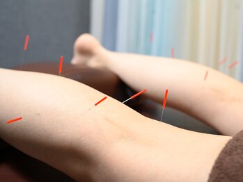 東船橋ひびき整骨院の写真/国家資格保持者が施術。鍼の力でお悩みを内側からサポート!
自分らしい健やかな毎日を♪