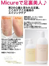 ミキュア(MICURE)/フット角質取り