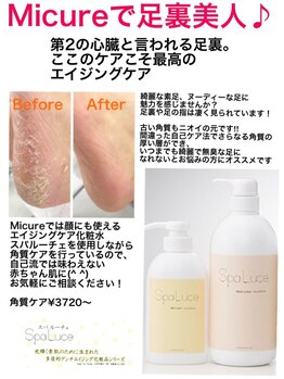 ミキュア(MICURE)/フット角質取り