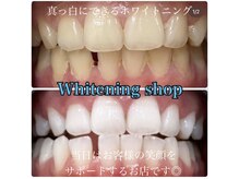 ホワイトニングショップ 柏店/美白ホワイトニング