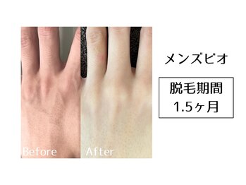 メンズビオ 神戸三宮店/