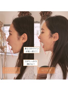 サンテリア(Santelia)/顎関節や開口でお悩みも