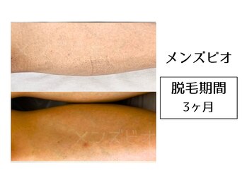 メンズビオ 神戸三宮店/