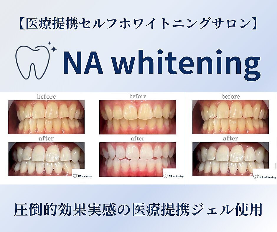 NA ホワイトニング 川崎溝の口店｜ホットペッパービューティー