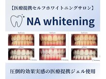 NA ホワイトニング 川崎店
