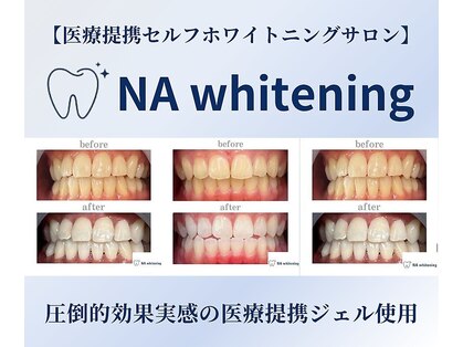 NA ホワイトニング 川崎溝の口店の写真