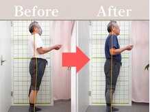 やわた姿勢整体院/68歳男性