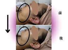 カリアンヌ/温活かっさフェイシャル/小顔