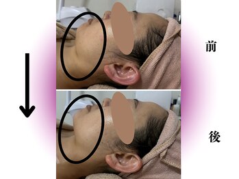 カリアンヌ/温活かっさフェイシャル/小顔